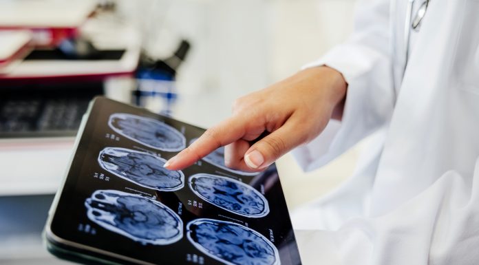 Premieră medicală la Spitalul Bagdasar-Arseni din București: operație pe creier cu pacientul treaz. „A fost foarte curajos”