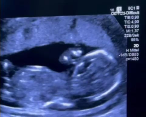 O femeie însărcinată, forţată să se deplaseze în Germania pentru tratament, după ce a trecut printr-o situaţie ”halucinantă” la Spitalul Filantropia din Bucureşti / Ce acuzaţii se aduc – FOTO / VIDEO