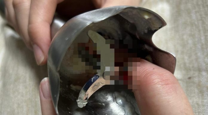 Două femei din Iași au ajuns la spital în urma unor accidente casnice grave