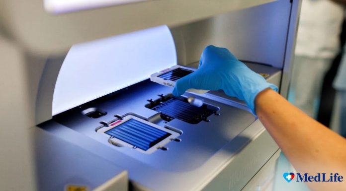 Testul genetic care poate indica riscul unor boli autoimune