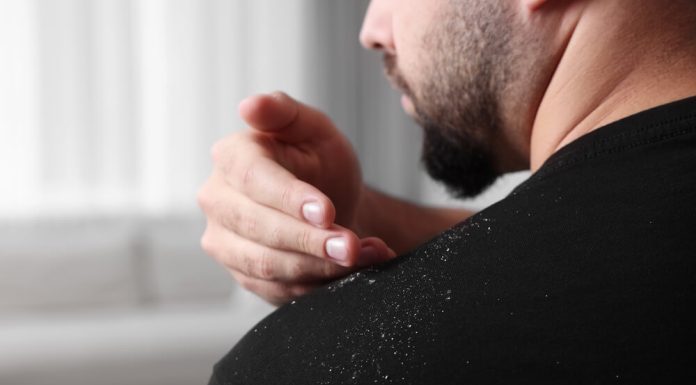 Șampon antimătreață: cum funcționează ingredientele active (P)