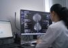 Accidentele vasculare cerebrale pot fi prevenite. Neurolog: “60-70% dintre cazuri au la bază cauze controlabile legate de mediul şi stilul de viaţă”