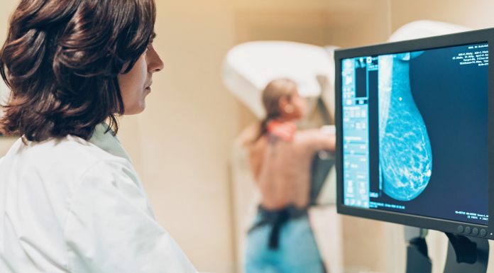 Cancerul de sân, descoperit prea târziu la mii de românce. Trei din patru paciente nu au făcut niciun control mamografic