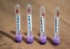 Focarul de hantavirus se extinde: Spania anchetează un caz suspect legat de nava MV Hondius