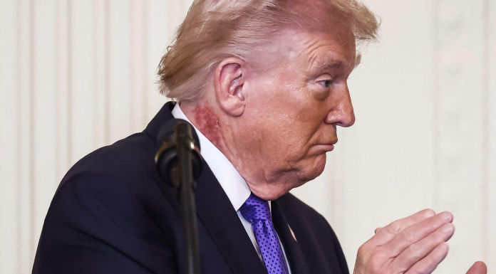 Donald Trump a fost supus celui de-al treilea control medical în 13 luni: ce a declarat președintele SUA care face 80 de ani în iunie