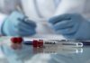 Suspiciune de infectare cu Ebola în Italia. Doi lucrători umanitari întorși din Uganda prezintă simptomele bolii