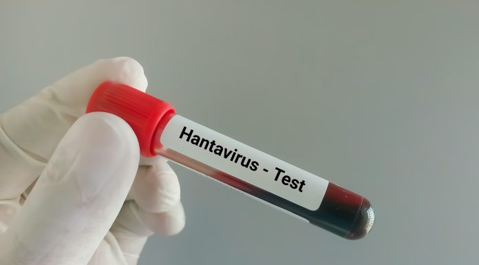 Spania anunţă că a depistat un caz suspect de hantavirus în Alicante