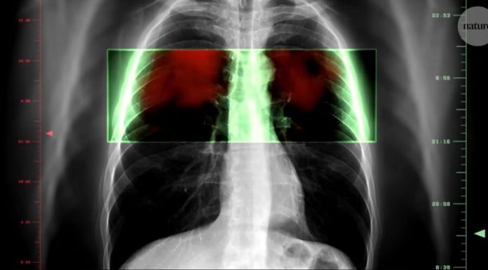 Nature – Ar putea o pastilă să prevină cel mai mortal tip de cancer din lume?/ VIDEO