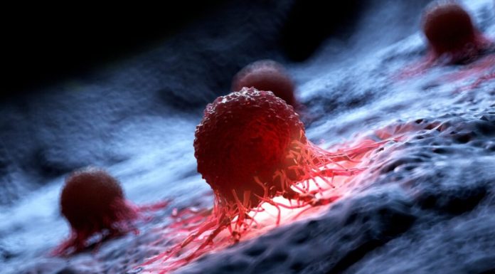 În SUA, a fost creat un vaccin personalizat împotriva cancerului cerebral, anunță Universitatea Washington