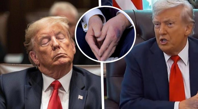 Donald Trump efectuează o vizită medicală înainte de a împlini 80 de ani: este al treilea control în 13 luni. Ce probleme au în atenție medicii