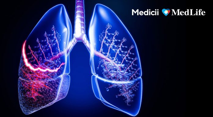 Medic pneumolog: „Nu ignora o tuse care durează mai mult de două luni”. Când simptomele respiratorii ascund afecţiuni serioase