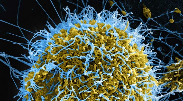 Brazilia investighează un caz suspect de Ebola, la Sao Paolo