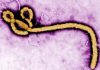 Ce se ştie până acum despre tulpina Bundibugyo a virusului Ebola?