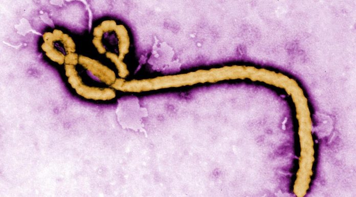 Ce se ştie până acum despre tulpina Bundibugyo a virusului Ebola?
