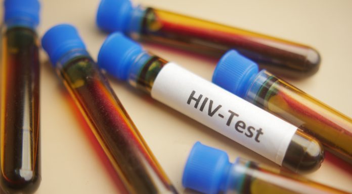 Studiu: O singură sesiune de terapie celulară poate ţine sub control infecţia cu HIV. Cum acționează