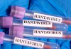 Un nou caz de hantavirus a apărut în Spania. Numărul persoanelor infectate a ajuns la 13