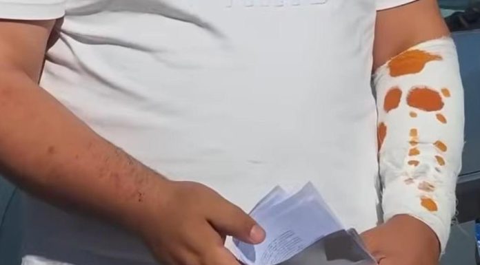 Bărbat atacat cu acid și amenințat cu cuțitul într-o benzinărie din Slatina. Spune că ordinul a venit de la Bercea Mondialu