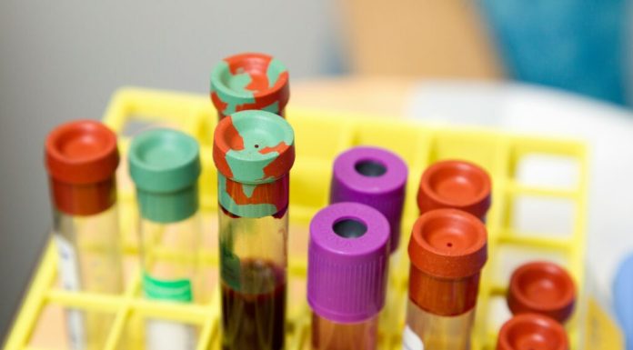 Aproape o treime din angajații în sănătate din Europa se confruntă cu risc de cancer la locul de muncă