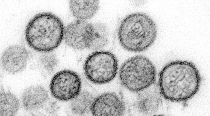 Hantavirus – experții lucrează la ghiduri pentru limitarea primului focar