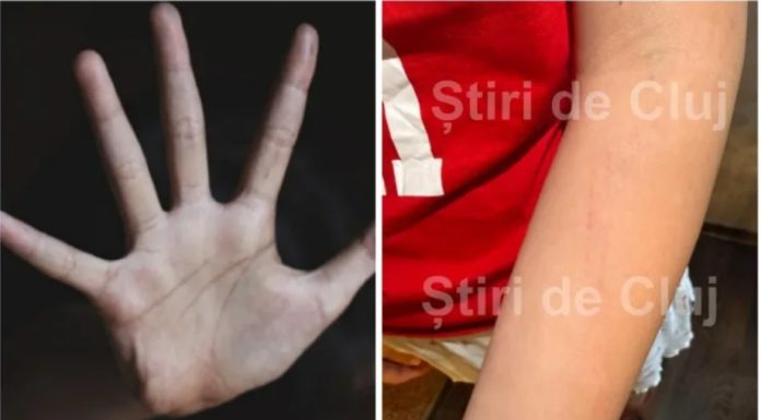 Cluj: Anchetă a Poliţiei după ce o tânără care a participat balul de absolvire a liceului a ajuns la spital, reclamând că a fost violată. Reprezentanţii unităţii de primiri urgenţe au anunţat autorităţile