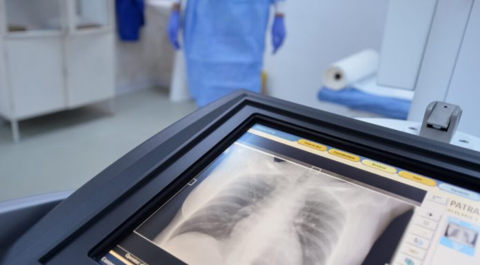 Nu este inima și nici creierul. Organul care ar putea influența longevitatea