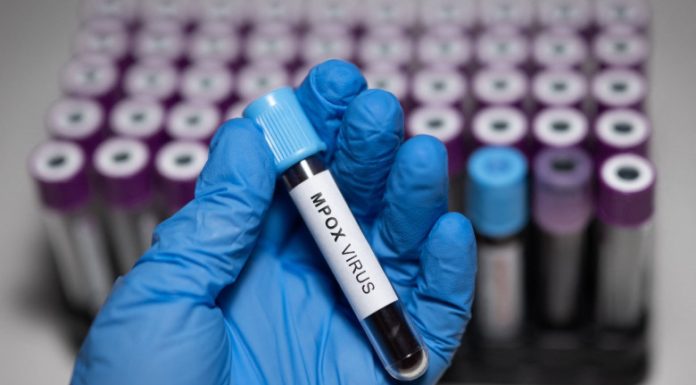 Doi oameni de știință, acuzați că au adus ilegal în SUA fiole cu virus mpox dezactivat din Africa și au mințit autoritățile