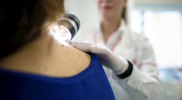 Primul centru multidisciplinar integrat pentru tratarea melanomului s-a deschis în cadrul Spitalului Euroclinic