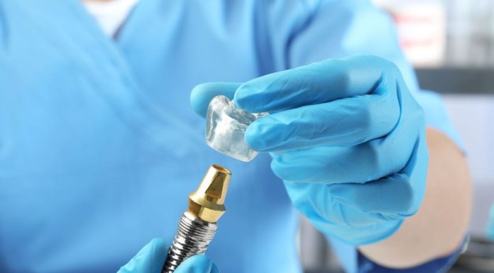 Ce include prețul unui implant dentar complet: De la consultatie la control final