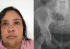 O femeie de 37 de ani din Brazilia s-a drept o fată de 12 ani pentru a păcăli o familie să o adopte. Ce a urmat