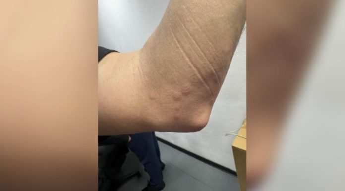 Bucureștenii riscă să ducă ploșnițe acasă după o călătorie cu metroul. Mecanicii acuză o infestare în spațiile de odihnă