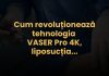 (P) Cum revoluționează tehnologia VASER Pro 4K, operația de liposucție la nivelul abdomenului, taliei și coapselor